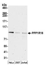 PPP1R18 Polyclonal Antibody