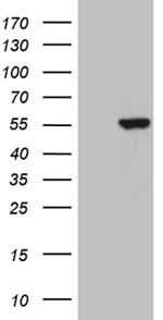 PPP1R36 Antibody in Western Blot (WB)