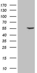 PPP1R36 Antibody in Western Blot (WB)