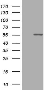 PPP1R36 Antibody in Western Blot (WB)