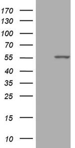 PPP1R36 Antibody in Western Blot (WB)