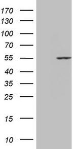 PPP1R36 Antibody in Western Blot (WB)