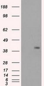 PPP1R7 Antibody in Western Blot (WB)