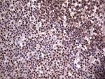 PPP1R8 Antibody in Immunohistochemistry (Paraffin) (IHC (P))