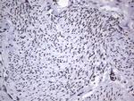 PPP1R8 Antibody in Immunohistochemistry (Paraffin) (IHC (P))