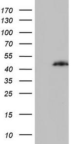 PPP1R8 Antibody in Western Blot (WB)