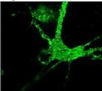 PPP1R9A Antibody in Immunocytochemistry (ICC/IF)
