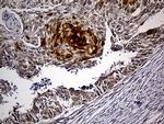 PPP2R1B Antibody in Immunohistochemistry (Paraffin) (IHC (P))