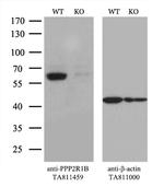 PPP2R1B Antibody in Western Blot (WB)
