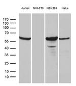 PPP2R1B Antibody in Western Blot (WB)