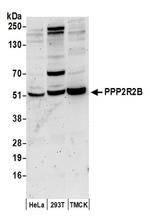 PPP2R2B Antibody in Western Blot (WB)