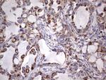 PPP2R5D Antibody in Immunohistochemistry (Paraffin) (IHC (P))