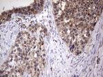 PPP2R5D Antibody in Immunohistochemistry (Paraffin) (IHC (P))