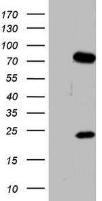 PPP2R5D Antibody in Western Blot (WB)