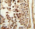 PPP3R2 Antibody in Immunohistochemistry (IHC)