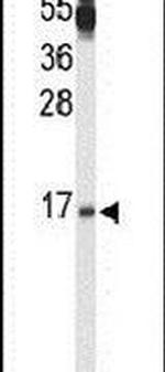 PPP3R2 Antibody in Western Blot (WB)