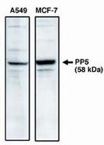 PP5 Polyclonal Antibody