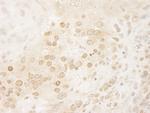 PPP5C Antibody in Immunohistochemistry (IHC)