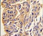 PPT1 Antibody in Immunohistochemistry (IHC)