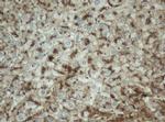 PPT1 Antibody in Immunohistochemistry (Paraffin) (IHC (P))