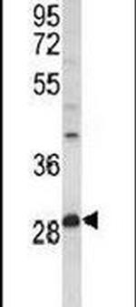 PPT1 Antibody in Western Blot (WB)