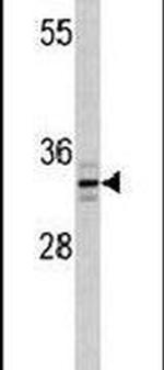 PPT1 Antibody in Western Blot (WB)