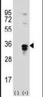PPT1 Antibody in Western Blot (WB)