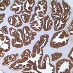 PPY Antibody in Immunohistochemistry (IHC)
