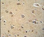 PQLC1 Antibody in Immunohistochemistry (IHC)