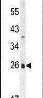 PQLC1 Antibody in Western Blot (WB)