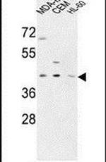 PR38A Antibody in Western Blot (WB)