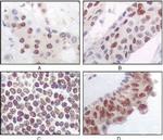 PRAK Monoclonal Antibody (7H10B4)