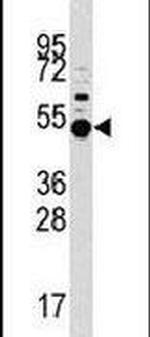 PRAK Antibody in Western Blot (WB)