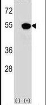 PRAK Antibody in Western Blot (WB)