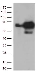 PRCC Antibody in Western Blot (WB)