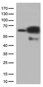 PRCC Antibody in Western Blot (WB)