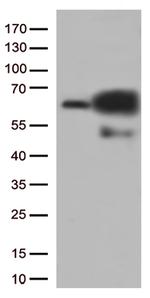 PRCC Antibody in Western Blot (WB)