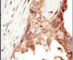 PRDM14 Antibody in Immunohistochemistry (IHC)