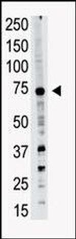 PRDM14 Antibody in Western Blot (WB)
