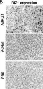 PRDM2 Antibody in Immunohistochemistry (IHC)