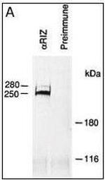 PRDM2 Antibody in Immunoprecipitation (IP)