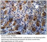 PRDM9 Polyclonal Antibody