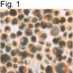 PRDX2 Antibody in Immunohistochemistry (IHC)