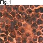 PRDX3 Antibody in Immunohistochemistry (IHC)