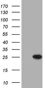 PRELID1 Antibody in Western Blot (WB)