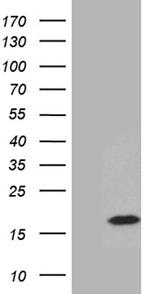 PRELID2 Antibody in Western Blot (WB)