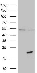 PRELID2 Antibody in Western Blot (WB)