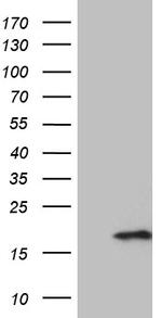 PRELID2 Antibody in Western Blot (WB)