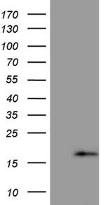 PRELID2 Antibody in Western Blot (WB)