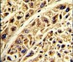 PRELP Antibody in Immunohistochemistry (IHC)
